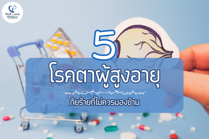 5 โรคตาผู้สูงอายุ ภัยร้ายที่ไม่ควรมองข้าม - ศูนย์ดูแลผู้สูงอายุลาดพร้าว