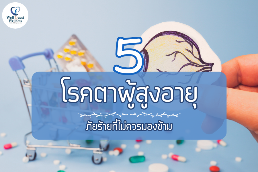 5 โรคตาผู้สูงอายุ ภัยร้ายที่ไม่ควรมองข้าม