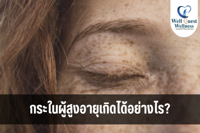 กระในผู้สูงอายุเกิดได้อย่างไร? - ศูนย์ดูแลผู้สูงอายุลาดพร้าว