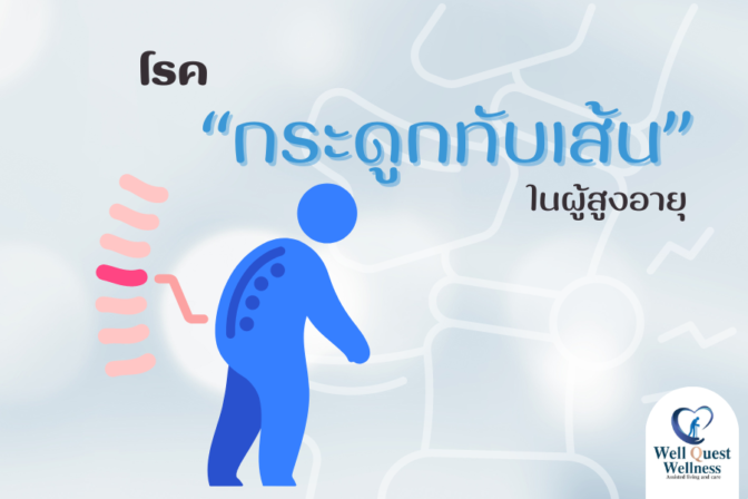 โรคกระดูกทับเส้นในผู้สูงอายุ - ศูนย์ดูแลผู้สูงอายุลาดพร้าว
