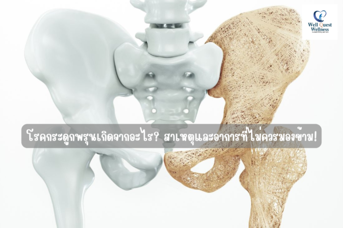 โรคกระดูกพรุนเกิดจากอะไร สาเหตุและอาการที่ไม่ควรมองข้าม!