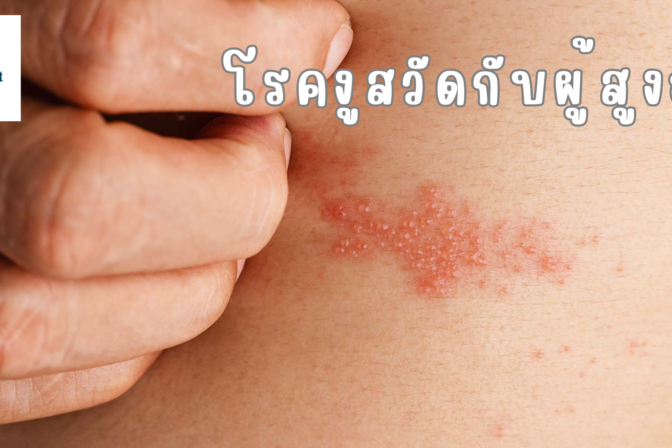 โรคงูสวัดกับผู้สูงอายุ_