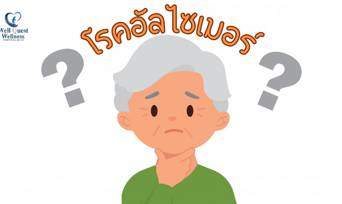 โรคอัลไซเมอร์_