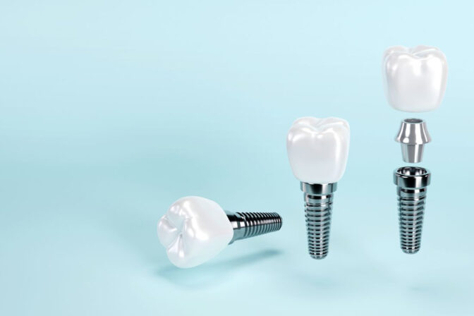 รากฟันเทียม